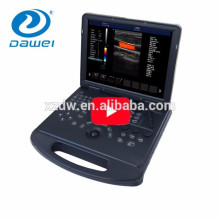 DW-C60 ordinateur portable base 4D fonction équipement couleur doppler machine à ultrasons portable